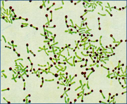 Corynebacterium diphtheriae